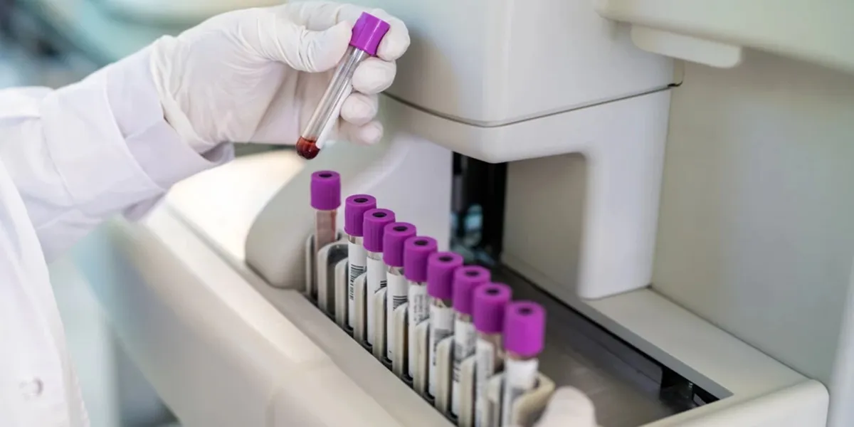 آزمایش پاتولوژی