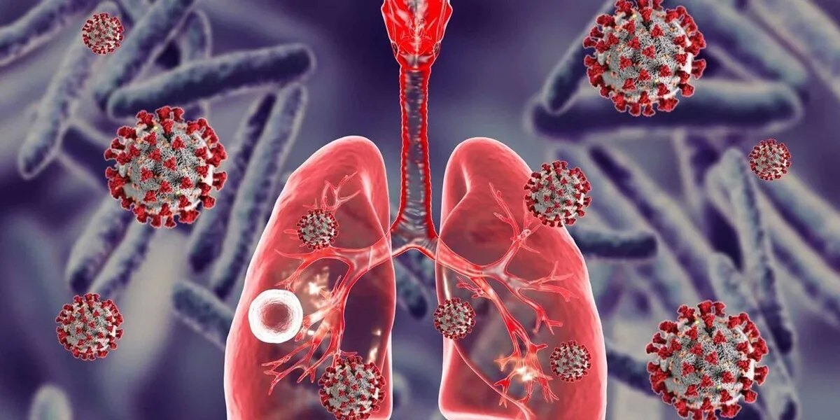 نحوه تشخیص بیماری سل